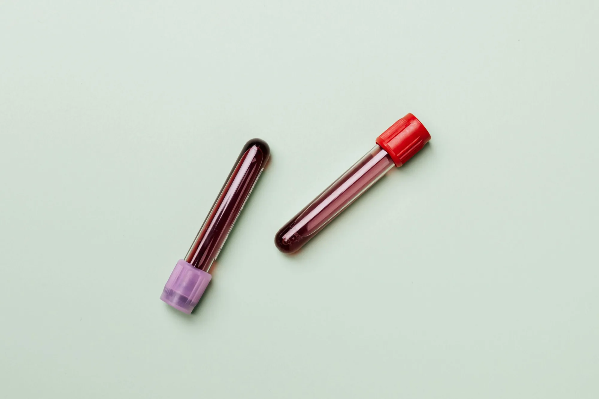 Vorbereitung einer PRP-Eigenplasma-Behandlung