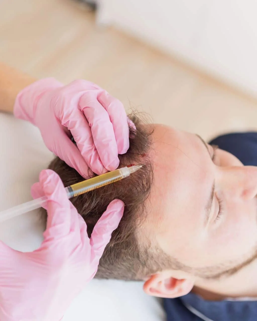 Natürliche Hautverjüngung durch PRP-Therapie