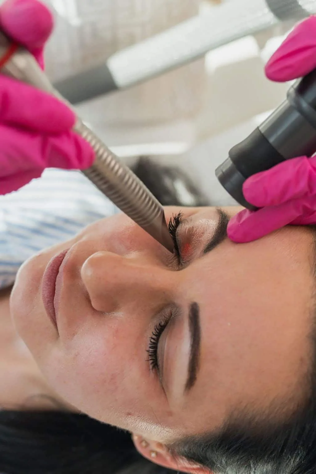 Ablauf der Smooth-Eye-Behandlung zur Faltenreduktion im Augenbereich